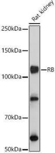 Western blot analysis of extracts of Rat kidney, using Anti-Rb Antibody (A93312) at 1:1000 dilution. The secondary Antibody was Goat Anti-Rabbit IgG H&L Antibody (HRP) at 1:10000 dilution. Lysates/proteins were present at 25 µg per lane