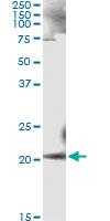 Anti-ANK1 Mouse Monoclonal Antibody [clone: 3C3]