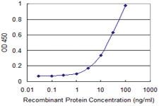 Anti-KCNMB3 Mouse Monoclonal Antibody [clone: 2C12]