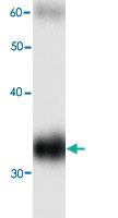 Anti-HBB Mouse Monoclonal Antibody [clone: 99g8]