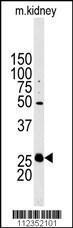 Anti-STC2 Rabbit Polyclonal Antibody (HRP (Horseradish Peroxidase))