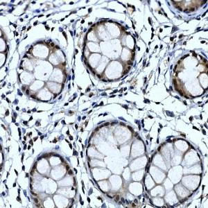 Immunohistochemistry analysis of paraffin-embedded human colon tissue using Anti-TH1L Antibody (A9551) at a dilution of 1:50 (40x lens) Perform high pressure antigen retrieval with 10 mM citrate buffer pH 60 before commencing with IHC staining protocol