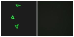 Immunofluorescence analysis of LOVO cells using Anti-BDKRB1 Antibody. The right hand panel represents a negative control, where the antibody was pre-incubated with the immunising peptide