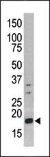 Anti-FAM109A Rabbit Polyclonal Antibody