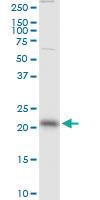 Anti-RAB13 Mouse Monoclonal Antibody [clone: 8H8]