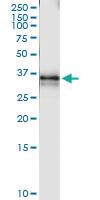 Anti-ZNF397 Rabbit Polyclonal Antibody