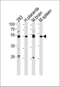 Anti-HINFP Rabbit Polyclonal Antibody (HRP (Horseradish Peroxidase))