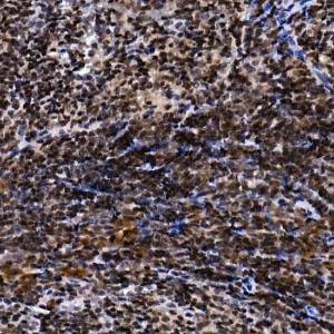 Immunohistochemistry analysis of paraffin-embedded mouse spleen using Anti-TH1L Antibody (A9551) at a dilution of 1:50 (40x lens) Perform high pressure antigen retrieval with 10 mM citrate buffer pH 60 before commencing with IHC staining protocol