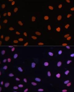 Immunofluorescence analysis of U-2 OS cells using Anti-Rb Antibody (A93312) at a dilution of 1:100. DAPI was used to stain the cell nuclei (blue)