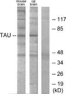 Western blot analysis of lysates from mouse brain and Rat brain cells using Anti-Tau Antibody. The right hand lane represents a negative control, where the Antibody is blocked by the immunising peptide