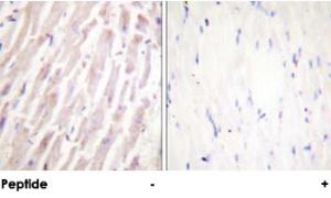 Anti-EPB49 Rabbit Polyclonal Antibody