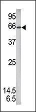 Anti-STAT1 Rabbit Polyclonal Antibody (AP (Alkaline Phosphatase))