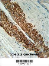 Anti-STEA2 Rabbit Polyclonal Antibody (AP (Alkaline Phosphatase))