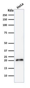 Western blot analysis of human HeLa cell lysate using Anti-p21 Antibody [CIP1/2275R]