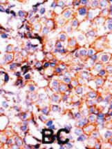 Anti-HIST3H3 Rabbit Polyclonal Antibody