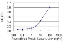 Anti-ANK1 Mouse Monoclonal Antibody [clone: 3C3]