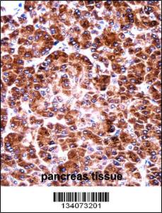 Anti-USO1 Rabbit Polyclonal Antibody (AP (Alkaline Phosphatase))