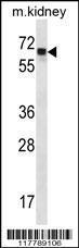 Anti-ANGPT2 Rabbit Polyclonal Antibody