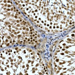 Immunohistochemistry analysis of paraffin-embedded rat testis using Anti-TH1L Antibody (A9551) at a dilution of 1:50 (40x lens) Perform high pressure antigen retrieval with 10 mM citrate buffer pH 60 before commencing with IHC staining protocol