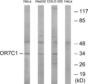 Anti-OR7C1 Rabbit Polyclonal Antibody