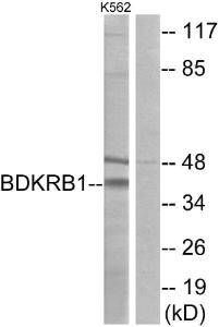 Western blot analysis of lysates from K562 cells using Anti-BDKRB1 Antibody. The right hand lane represents a negative control, where the antibody is blocked by the immunising peptide