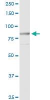 Anti-MST1 Rabbit Polyclonal Antibody