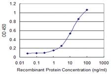 Anti-EFHC1 Mouse Monoclonal Antibody [clone: 4E7]