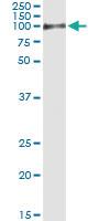 Anti-PTBP1 Antibody Pair