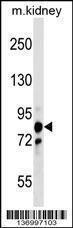 Anti-PNPT1 Rabbit Polyclonal Antibody (AP (Alkaline Phosphatase))