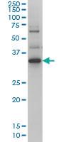 Anti-ZIC4 Mouse Monoclonal Antibody [clone: 4B1]