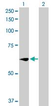 Anti-WEE1 (WEE1 G2 checkpoint kinase) Rabbit Polyclonal Antibody