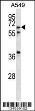 Anti-GLP2R Rabbit Polyclonal Antibody (AP (Alkaline Phosphatase))