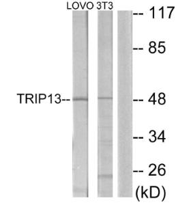 Western blot analysis of lysates from LOVO and NIH/3T3 cells using Anti-TRIP13 Antibody. The right hand lane represents a negative control, where the antibody is blocked by the immunising peptide