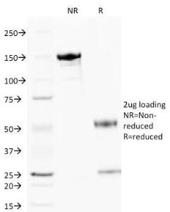 SDS-PAGE analysis of Anti-Cytochrome C Antibody [6H2B4] under non-reduced and reduced conditions; showing intact IgG and intact heavy and light chains, respectively SDS-PAGE analysis confirms the integrity and purity of the antibody