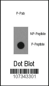 Anti-ABL1 Rabbit Polyclonal Antibody