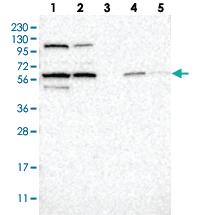 Anti-ZNF454 Rabbit Polyclonal Antibody