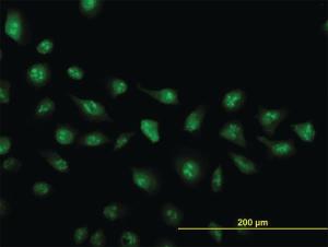 Anti-ZIC4 Mouse Monoclonal Antibody [clone: 4B1]