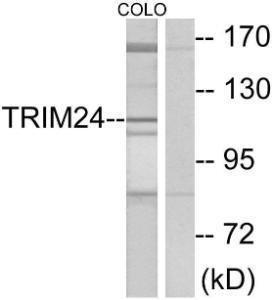 Western blot analysis of lysates from COLO cells using Anti-TRIM24 Antibody. The right hand lane represents a negative control, where the antibody is blocked by the immunising peptide