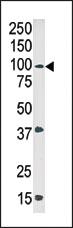 Anti-ABL1 Rabbit Polyclonal Antibody