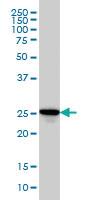 Anti-RAB27A Mouse Monoclonal Antibody [clone: 1G7]