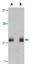 Anti-FGF4 Rabbit Polyclonal Antibody