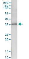 Anti-NKD2 Polyclonal Antibody Pair