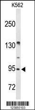 Anti-BRINP3 Rabbit Polyclonal Antibody (Biotin)