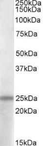 Anti-ADCYAP1 Antibody (A83635) (1 µg/ml) staining of Human Hippocampus lysate (35 µg protein in RIPA buffer) Primary incubation was 1 hour Detected by chemiluminescence