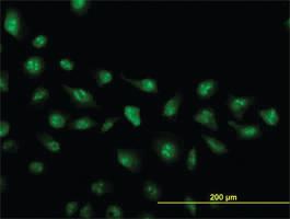 Anti-ZIC4 Mouse Monoclonal Antibody [clone: 4B1]