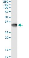 Anti-FCN3 Antibody Pair