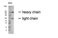 Anti-CEACAM16 Mouse Monoclonal Antibody [clone: 14A1]