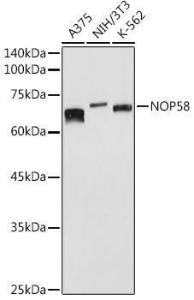 Anti-NOP58 Rabbit Polyclonal Antibody