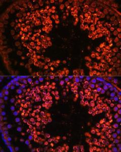 Immunofluorescence analysis of rat testis using Anti-UBQLN3 Antibody (A309177) at a dilution of 1:100 DAPI was used to stain the cell nuclei (blue)