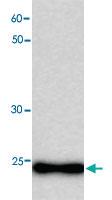 Anti-MB Mouse Monoclonal Antibody [clone: 34h5]